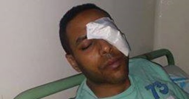 التحقيق مع الضابط المتهم بتصفية عين مواطن فى حدائق القبة.. حسين للنيابة: طالبته بالتعامل معى بالقانون فضربنى بـالبوكس.. ويؤكد لـ"اليوم السابع": مستقبلى هيضيع وأطالب وزير الداخلية بمعاقبة الشرطى