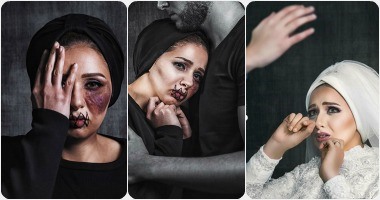 سلسلة صور تحكى قصة المرأة المعنفة من الفستان الأبيض للكدمات البنفسجية