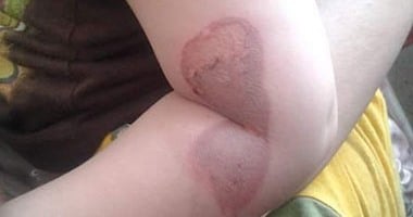 تأديب أم تعذيب.. آباء يقتلون أبناءهم خوفاً عليهم.. 3 جرائم ضحيتها 4 أطفال خلال ساعات.. أستاذ علم نفس: سلوك الأبوين وغياب القدوة السبب.. محام: جريمة ضرب أفضى إلى موت وعقوبتها المشدد من 3 إلى 7 سنوات