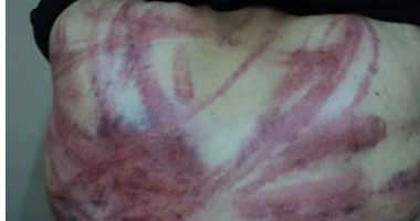 بالصور.. خطف وتعذيب مواطن مصرى فى مدينة سبها الليبية