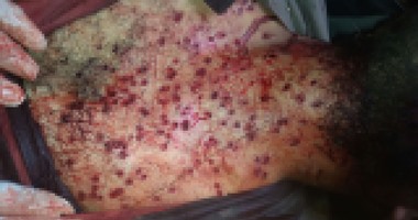 إصابة شخصين فى مشاجرة بسبب خلافات عائلية بالجيزة 