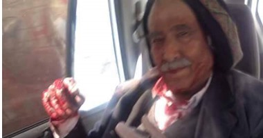 بالصور.. إصابة وزير الدفاع اليمنى السابق فى غارة للتحالف