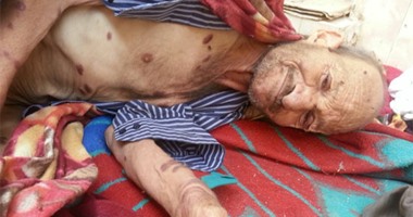 الإكثار من النوم أو الإقلال منه قد يؤدى إلى بدايات تصلب الشرايين