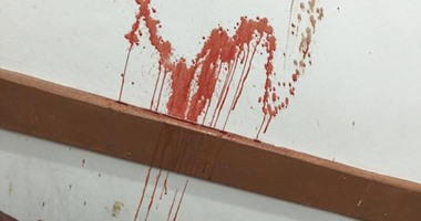 بالصور.. الدماء تلطخ حوائط غرفة الغسيل الكلوى بمستشفى إدفو العام