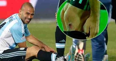 ماسكيرانو استكمل نهائى كوبا أميركا رغم الإصابة