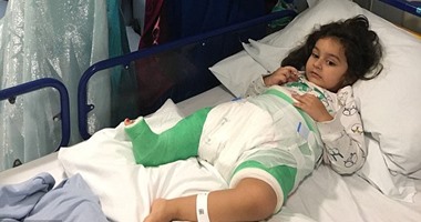 ديلى ميل: مرض نادر يصيب طفلة بقصر طول ساقها اليمنى والسبب ليس وراثيا