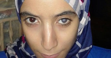 بعد رفض الصحة علاجها.. "منار" فقدت بصرها وتحتاج لعملية زرع قرنية