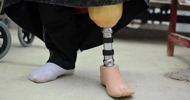 جمعية رسالة للأعمال الخيرية توفر أطرافا صناعية لأطفال وشباب بتكلفة تصل إلى 300 ألف جنيه