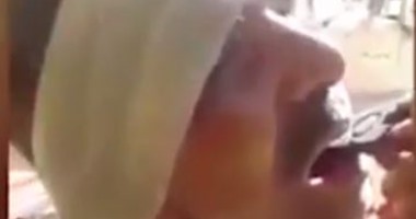رجل بريطانى يخلع أسنانه باستخدام "كماشة" لغلاء أسعار أطباء الأسنان