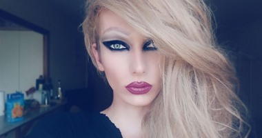 التحول الجنسى.. أسبابه وأعراضه وشروط إجراء العملية
