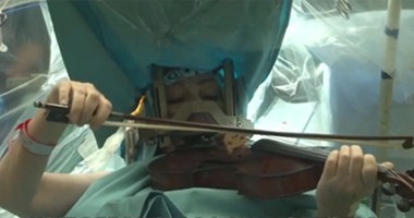 "التليجراف" تنشر فيديو لامرأة تعزف الكمان أثناء خضوعها لعملية بالمخ