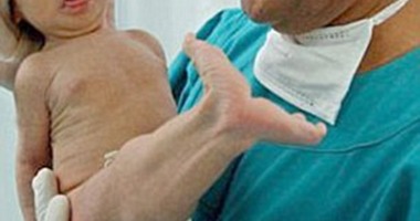 بالصور.. ولادة عروس بحر بشرية فى أمريكا