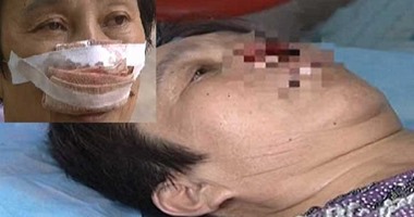 بالفيديو..سيدة صينية: زوجى أكل أنفى وبلعها لأنى لم أرد على اتصاله