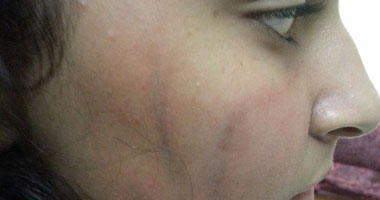 خبيرة دولية: العنف ضد المرأة مشكلة قائمة فى كل دول العالم