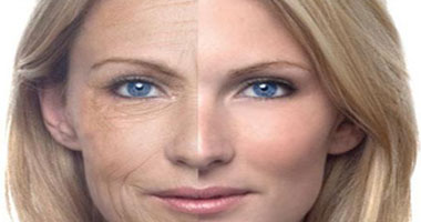 "الخيوط الأمريكية" تخلصك من تجاعيد الوجه لمدة سنتين