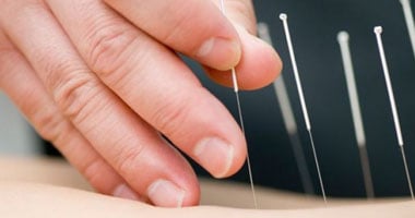 لو بتعانى من ضعف الخصوبة وقلة التبويض.. الحل فى الإبر الصينية