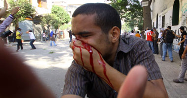 عشرات الجرحى والمصابين حصيلة اشتباكات التحرير