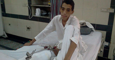  8 أطعمة محظورة على مريض النقرس