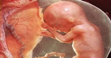 38% يعانون من "التقزم الغذائى".. نتيجة تدهور صحة الجنين