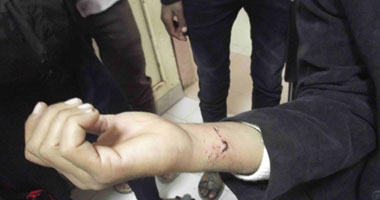 إصابة 7 أطفال عقرهم حيوان مجهول فى أسوان