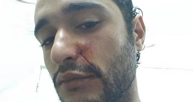 أحمد دومة لـ مرسى: نعدكم بأن هذه الدماء والجثث ستكون لعنة عليكم
