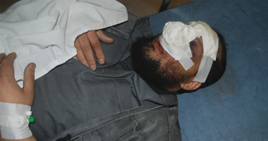 النيابة تستعجل تحريات المباحث لضبط المتهمين فى حادث "البلكيمى"