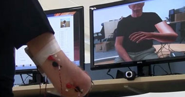 تقنية جديدة لعلاج "الألم الوهمى" لدى مبتورى الأطراف