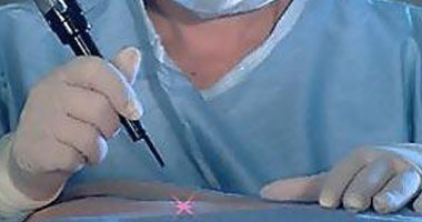 هل هناك خطر من إجراء عمليات تجميل للمراهقين؟