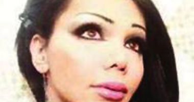 شاب لبنانى يجرى عملية جراحية للتشبه بـ"أليسا"