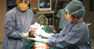 للحوامل.. تعرفى على أسباب حدوث النزيف بعد الولادة