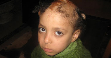 منة.. مطلوب طبيب.. يكون قلبه رحيما