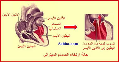 هل أدوية السيولة تؤثر على صحة الجنين؟