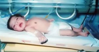 20 ألف فتاة أقل من 18 عاما تضع طفلا يوميا فى العالم