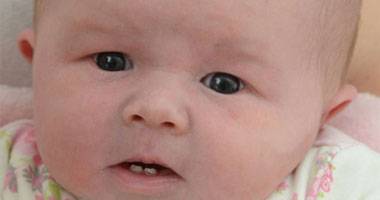 7 نصائح لصحة طفلك فى فترة التسنين أهمها تعرضه للشمس والبعد عن الحمضيات