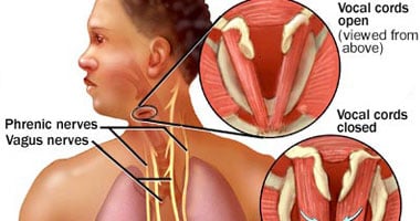 كيف نحافظ على الأحبال الصوتية؟