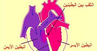 عضلة قلبى ضعيفة هل يمكن أن تعود إلى كفاءتها؟