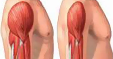 تعرف على تأثير اضطرابات هرمون الثيروكسين على العظام والعضلات