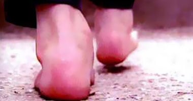 أعانى آلاما بالفخذ إلى كعب القدم عند الجلوس فما العلاج؟
