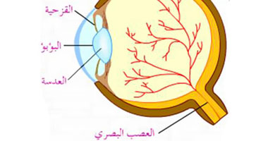 تعرف على أعراض وأسباب التهاب العصب البصرى